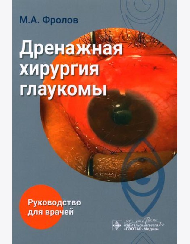 Дренажная хирургия глаукомы: руководство для врачей