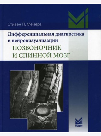 Дифференциальная диагностика в нейровизуализации. Позвоночник и спинной мозг