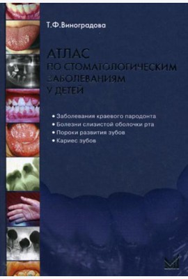 Атлас по стоматологическим заболеваниям у детей: учебное пособие. 2-е изд. + CD