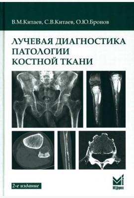 Лучевая диагностика патологии костной ткани. 2-е изд