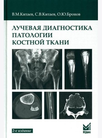 Лучевая диагностика патологии костной ткани. 2-е изд