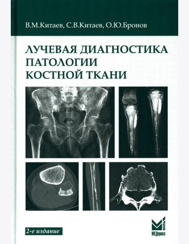 Лучевая диагностика патологии костной ткани. 2-е изд