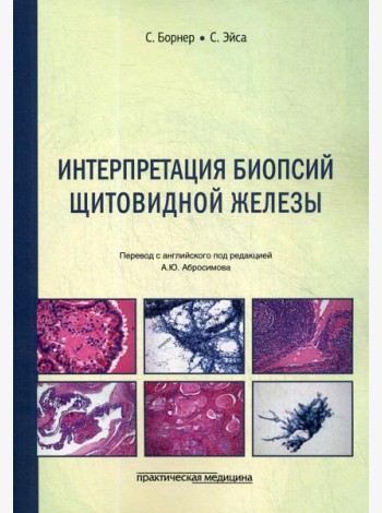 Интерпретация биопсий щитовидной железы