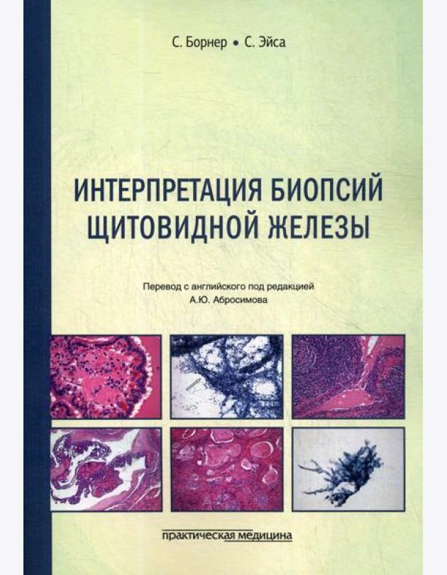 Интерпретация биопсий щитовидной железы
