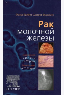 Рак молочной железы