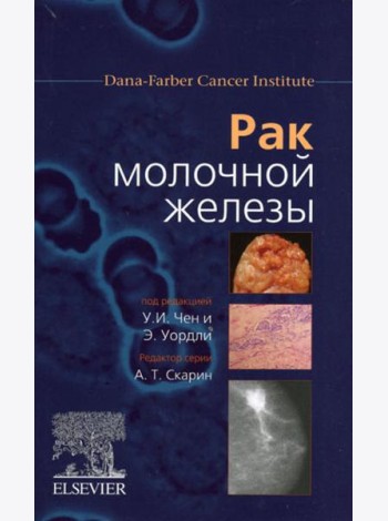 Рак молочной железы