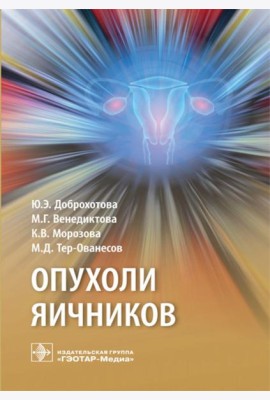 Опухоли яичников: руководство