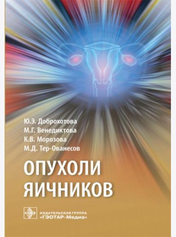 Опухоли яичников: руководство