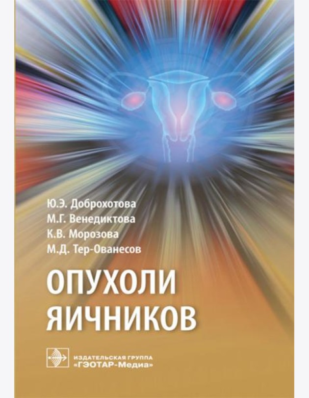 Опухоли яичников: руководство