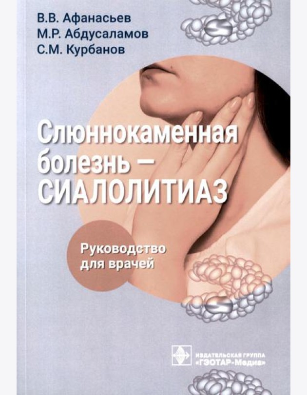Слюннокаменная болезнь - сиалолитиаз: руководство для врачей