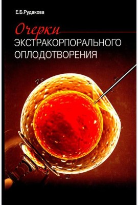 Очерки экстракорпорального оплодотворения