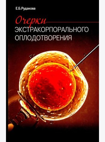 Очерки экстракорпорального оплодотворения