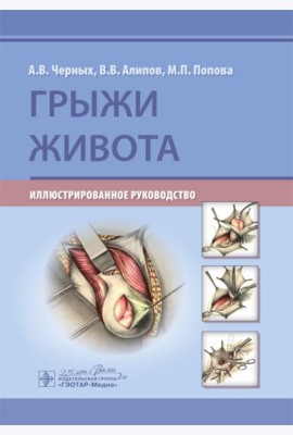 Грыжи живота: иллюстрированное руководство