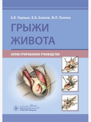 Грыжи живота: иллюстрированное руководство