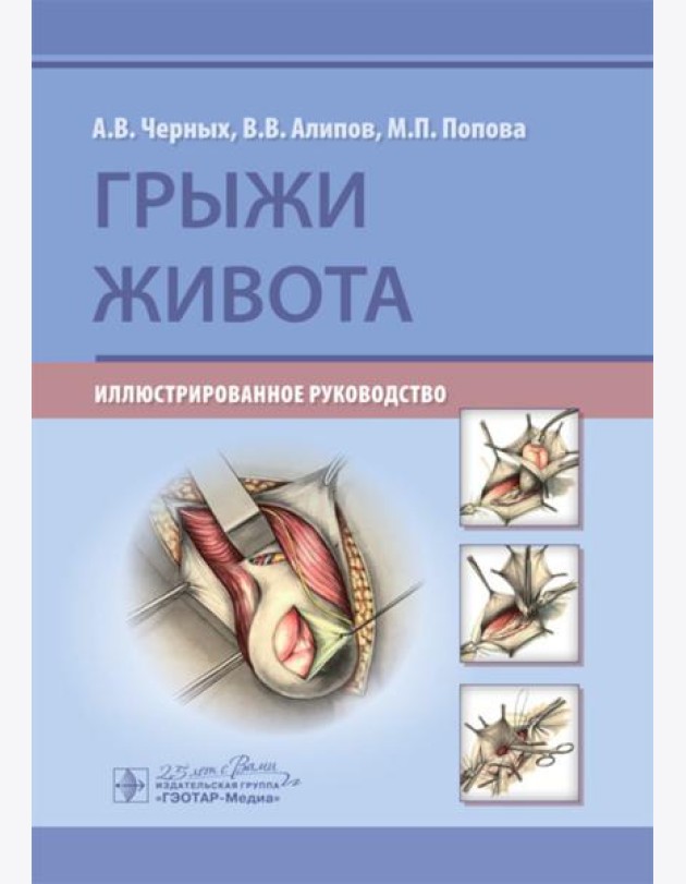 Грыжи живота: иллюстрированное руководство