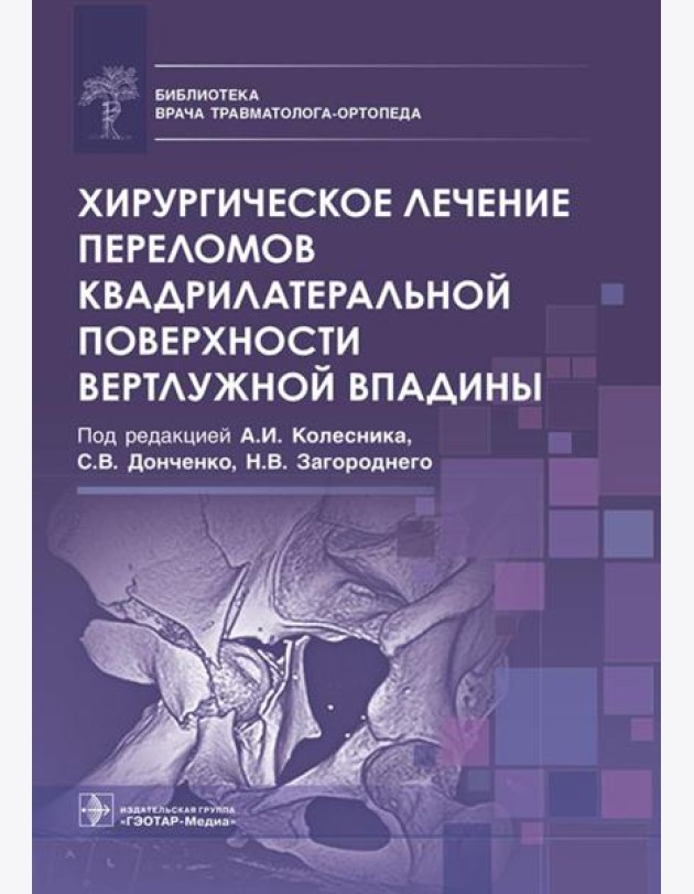 Хирургическое лечение переломов квадрилатеральной поверхности вертлужной впадины