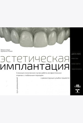 Эстетическая имплантация. Сложные клинические случаи работы во фронтальных отделах с глобальным подходом к реконструкции улыбки пациента