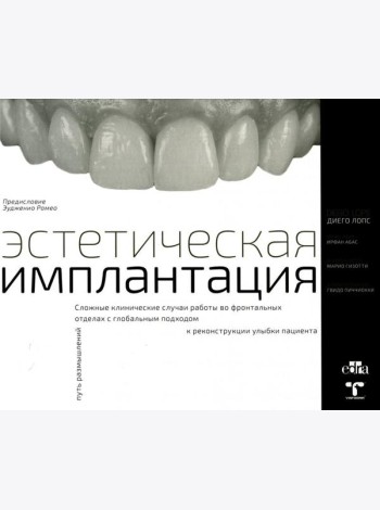 Эстетическая имплантация. Сложные клинические случаи работы во фронтальных отделах с глобальным подходом к реконструкции улыбки пациента