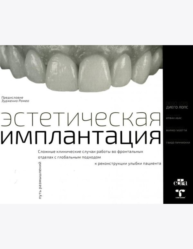 Эстетическая имплантация. Сложные клинические случаи работы во фронтальных отделах с глобальным подходом к реконструкции улыбки пациента