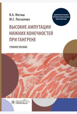 Высокие ампутации нижних конечностей при гангрене: Учебное пособие
