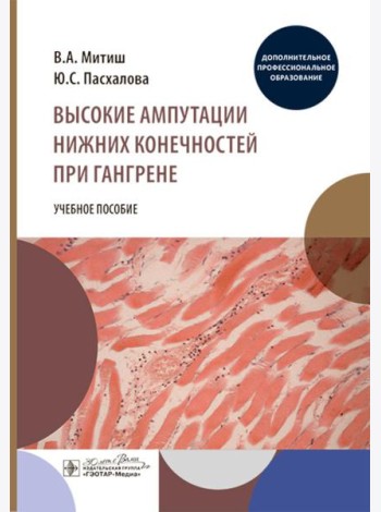Высокие ампутации нижних конечностей при гангрене: Учебное пособие