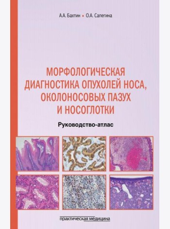 Морфологическая диагностика опухолей носа, околоносовых пазух и носоглотки. Руководство-атлас
