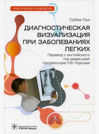 Диагностическая визуализация при заболеваниях легких. Практическое руководство
