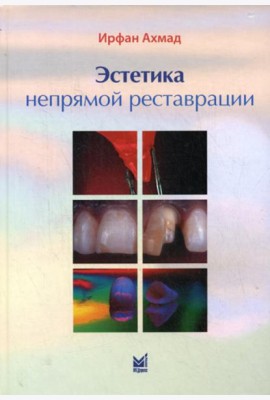 Эстетика непрямой реставрации