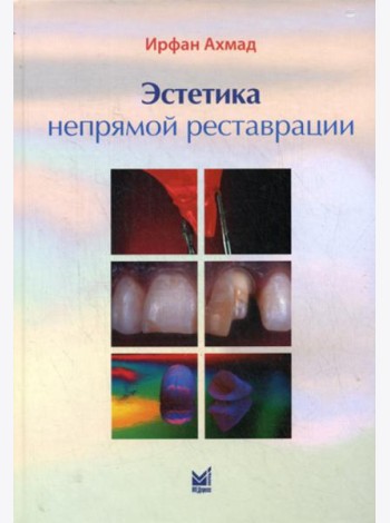 Эстетика непрямой реставрации