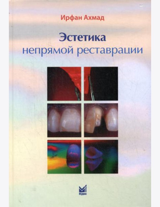 Эстетика непрямой реставрации