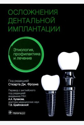 Осложнения дентальной имплантации. Этиология, профилактика и лечение