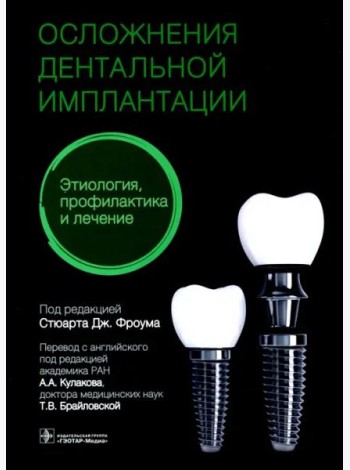 Осложнения дентальной имплантации. Этиология, профилактика и лечение