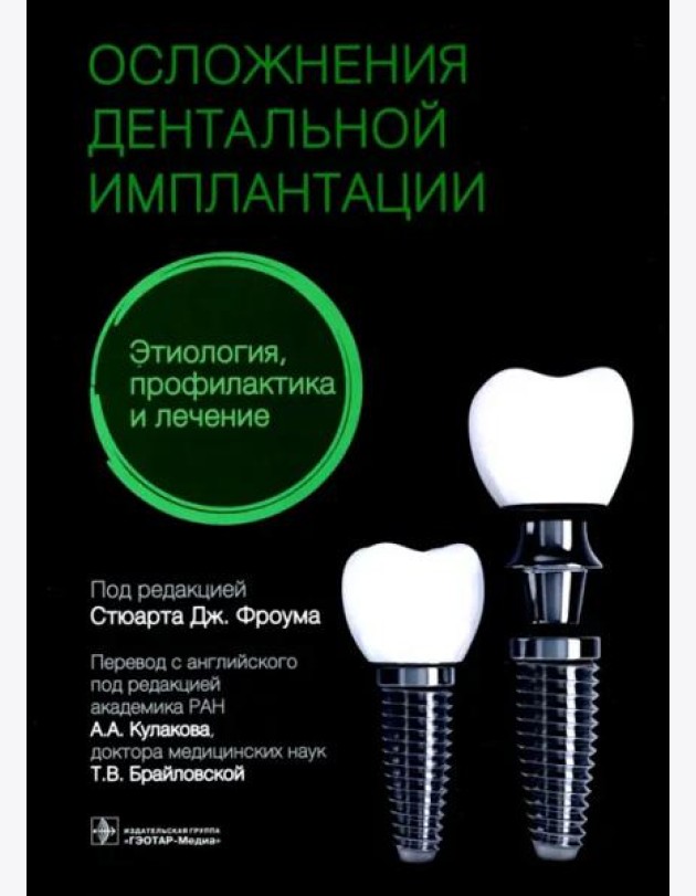 Осложнения дентальной имплантации. Этиология, профилактика и лечение