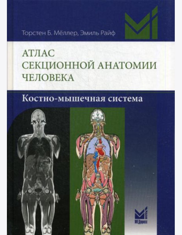 Атлас секционной анатомии человека. Костно-мышечная система