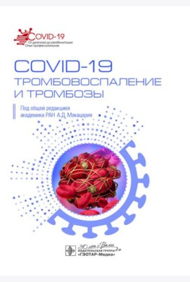 COVID-19, тромбовоспаление и тромбозы: руководство для врачей