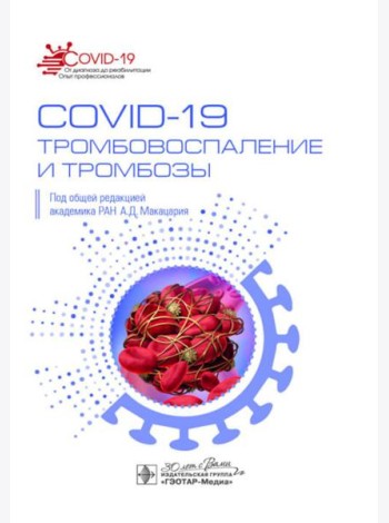 COVID-19, тромбовоспаление и тромбозы: руководство для врачей