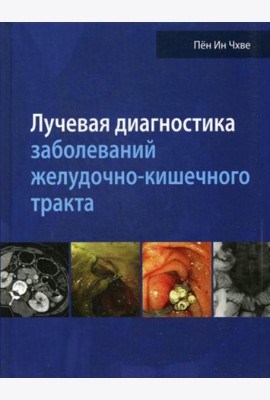 Лучевая диагностика заболеваний желудочно-кишечного тракта