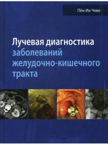 Лучевая диагностика заболеваний желудочно-кишечного тракта