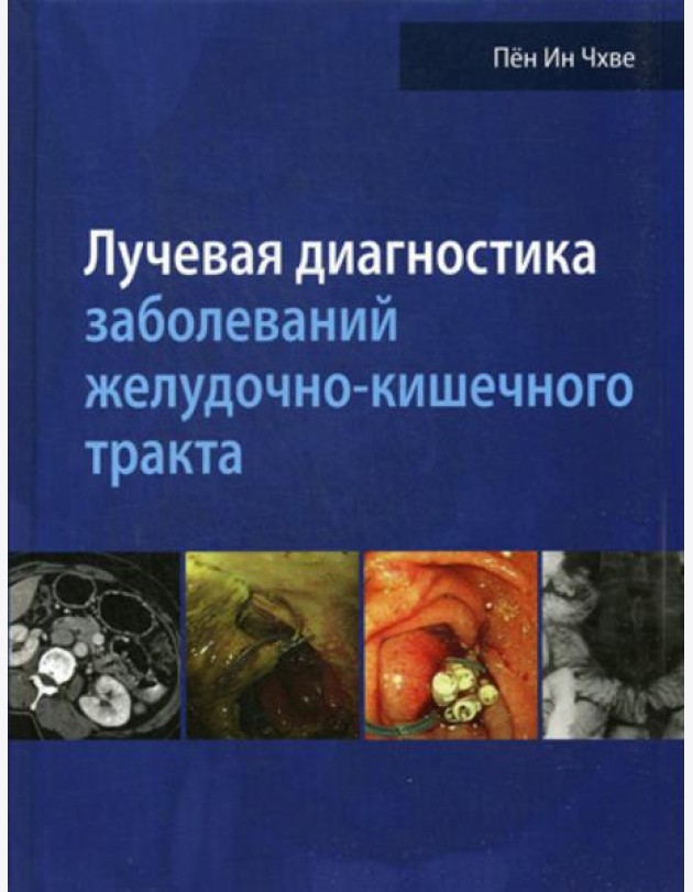 Лучевая диагностика заболеваний желудочно-кишечного тракта