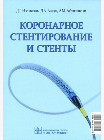 Коронарное стентирование и стенты