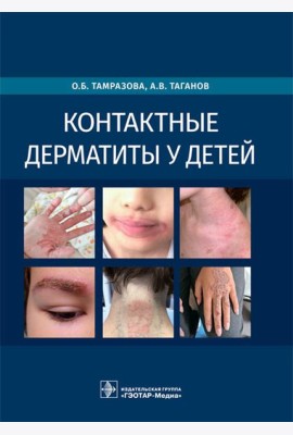 Контактные дерматиты у детей
