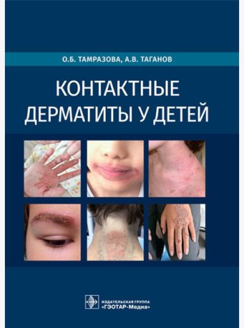 Контактные дерматиты у детей