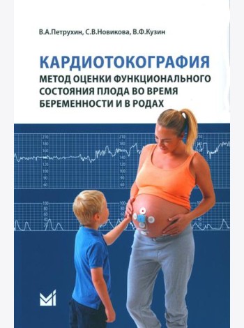 Кардиотокография - метод оценки функционального состояния плода во время беременности: Учебное пособие. 2-е изд