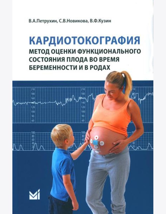 Кардиотокография - метод оценки функционального состояния плода во время беременности: Учебное пособие. 2-е изд