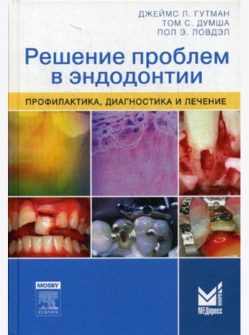 Решение проблем в эндодонтии. Профилактика, диагностика и лечение. 2-е изд