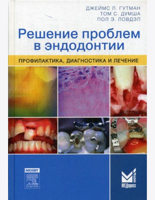 Решение проблем в эндодонтии. Профилактика, диагностика и лечение. 2-е изд