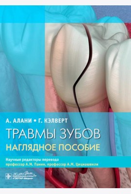 Травмы зубов. Наглядное пособие