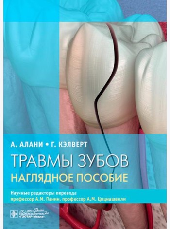 Травмы зубов. Наглядное пособие