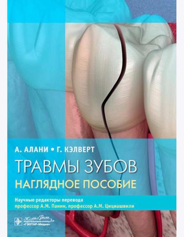 Травмы зубов. Наглядное пособие