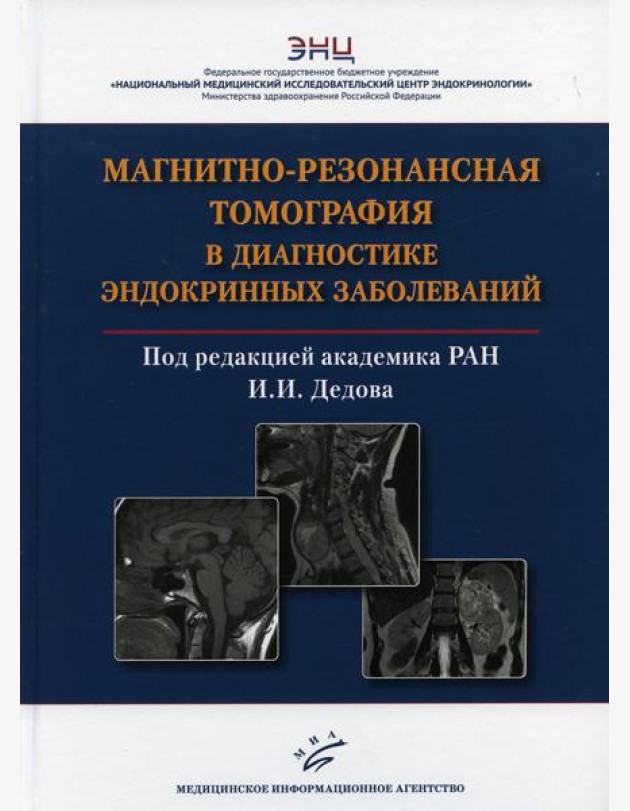 Магнитно-резонансная томография в диагностике эндокринных заболеваний